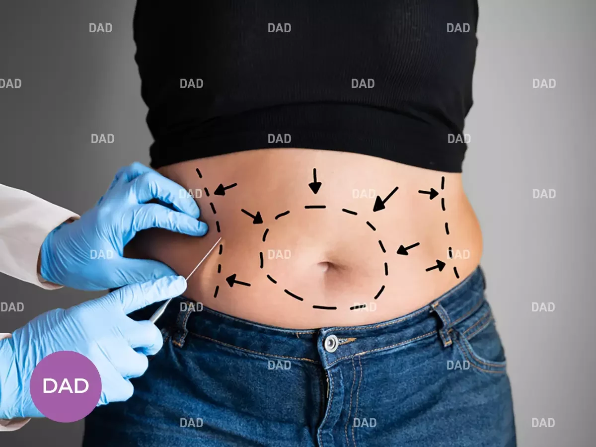 abdominoplasty surgeon