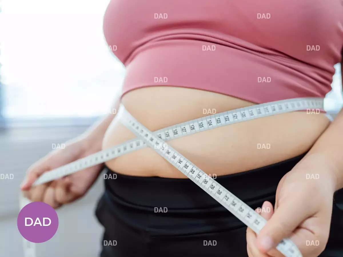 Abdominoplasty Result