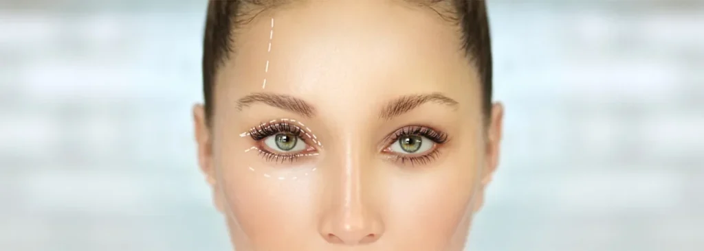 Best Eyelid Ptosis Surgeon in Iran