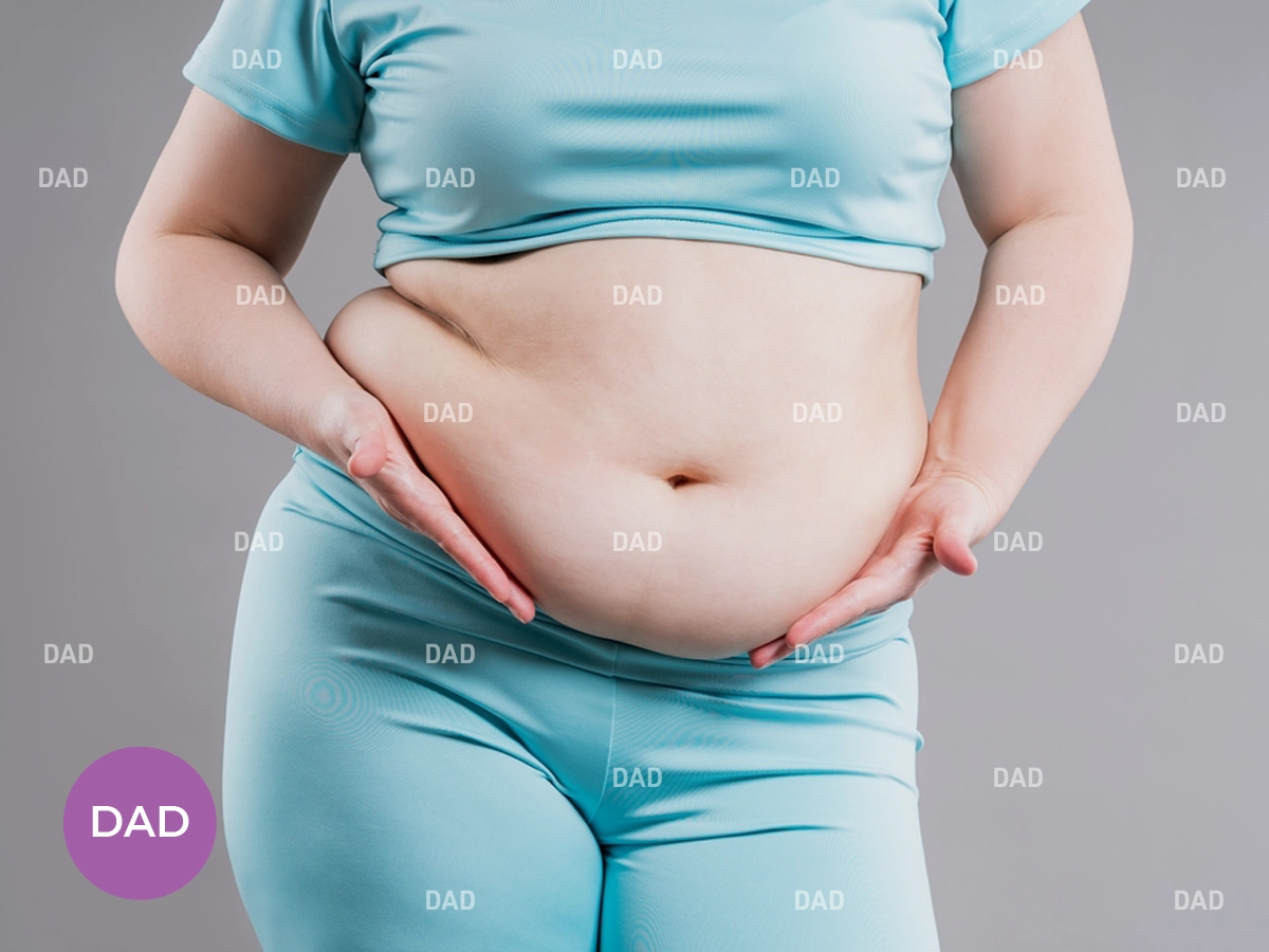 Best Abdominoplasty Surgeon in Tehran